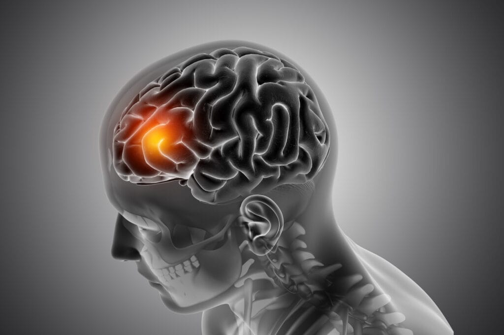 a male medical figure with concussion
